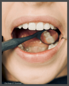 Close-up of dental exam — mirror and tool inspecting teeth